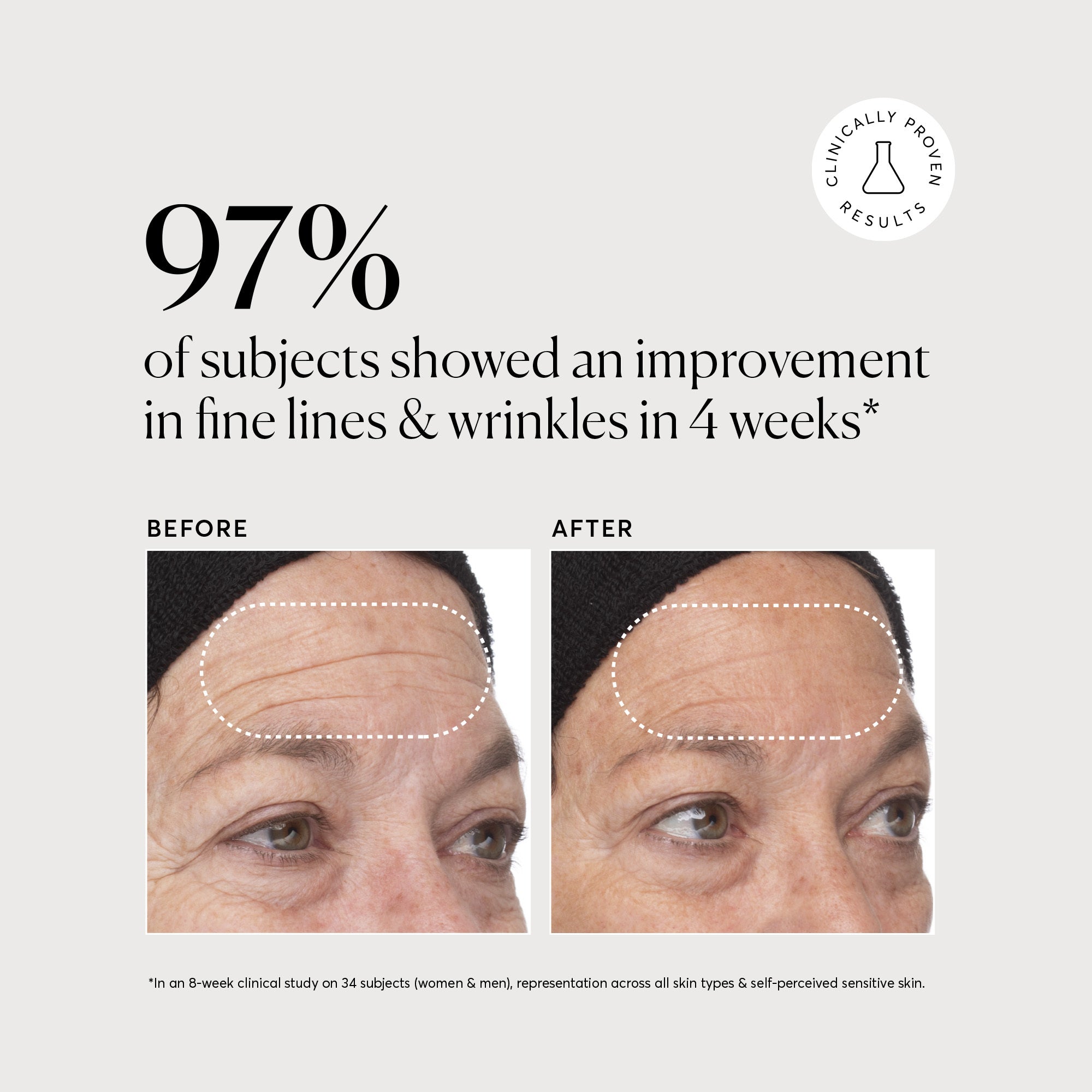 NATR_Retinol_Clinical_Graphics_B_A_1_1