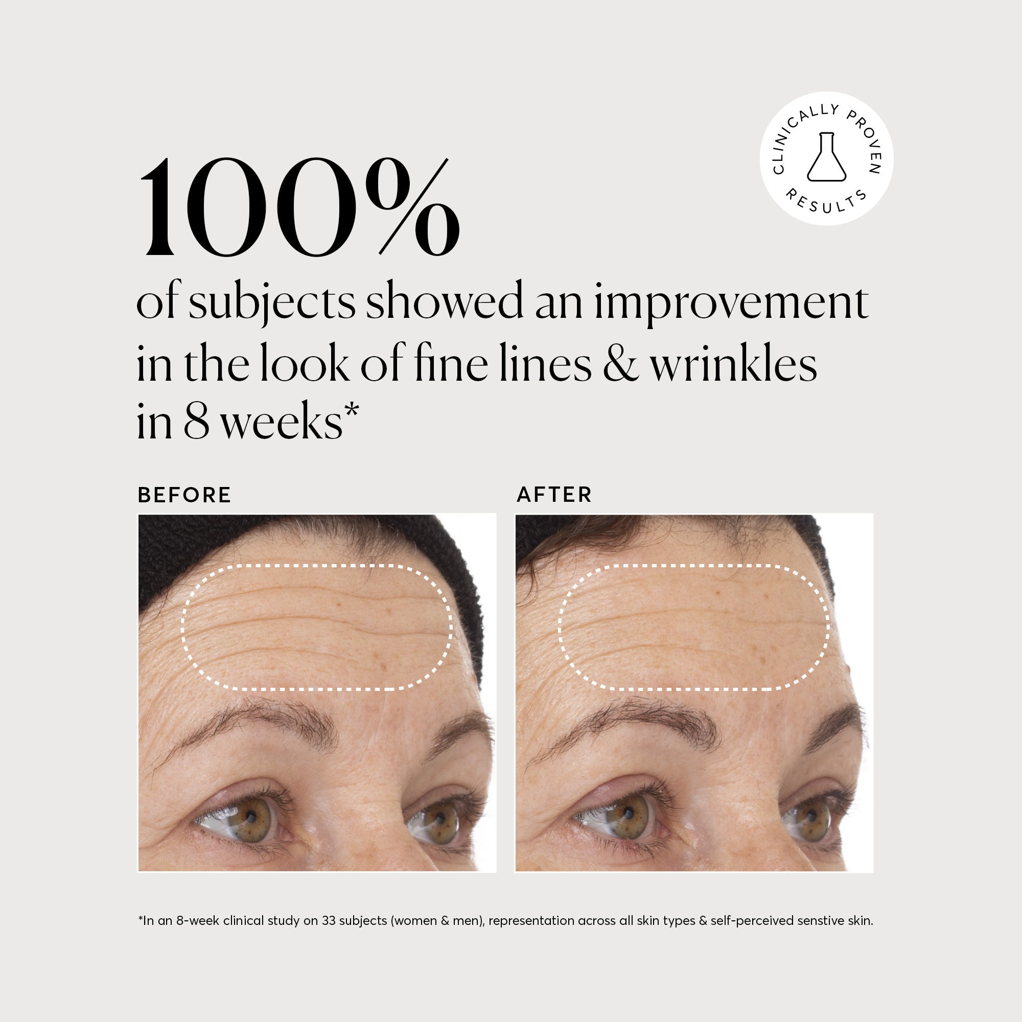 NATR_VitC_Clinical_Graphics_B_A_1_Bone